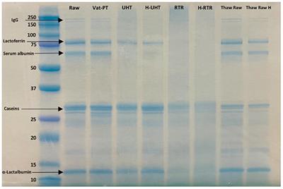 Structural and functional changes of bioactive proteins in donor human milk treated by vat-pasteurization, retort sterilization, ultra-high-temperature sterilization, freeze-thawing and homogenization